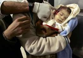 Image result for children palestine slaughtered