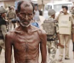 Image result for starving people