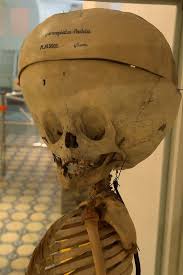 The Narrenturm in Vienna, a special fascinating place in my hometown. It was built so that the shape of the hallways resembles occult symbols and has been place to occult rituals and