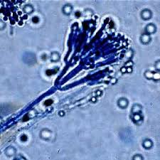 Image result for Penicillium sp. MA 6040