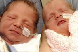 ABANDONED twins Holly and Joseph doze contentedly in the care of hospital ... - 000DC7BC-FE45-1397-AEBD0C01AC1BF814-568349