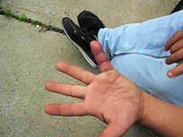 Résultat de recherche d'images pour "copperhead bites"