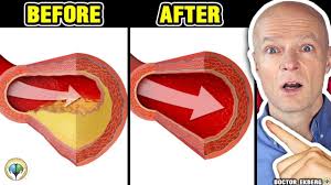 My Training Log Hates Tired After Eating? How to Prevent Post-Meal Blood Sugar Spikes [Rr4Ujx6FsY]