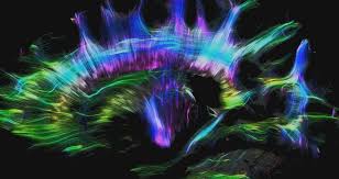 Picture of Tractography