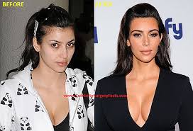 Résultat de recherche d'images pour "who is kim kardashian before and after"