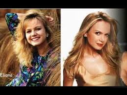 Resultado de imagem para antes e depois dos artistas brasileiros