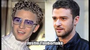 Resultado de imagem para antes e depois dos famosos