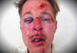 [img width=270 height=187]https://encrypted-tbn2.gstatic.com/images?q=tbn:ANd9GcSoHQe1RCPvFgbbIsHiw-yD1WtjPuVeH8xRWs0pzgNkGX6nRyuQ[/img]