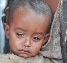 Image result for starving people