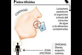 Resultado de imagen para fiebre tifoidea PREVENCION