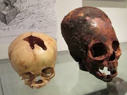 Elongated Human Skulls At The Paracas History Museum In Peru - Hidden Inca Tours