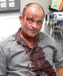 BEATEN: Don Scott was assaulted and had his camera stolen while sitting in his company car as a colleague interviewed a person at a Cass St property. - 6809943