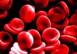 Image result for IMAGES OF DIAGNOSIS OF ANEMIA