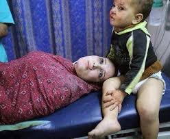 Image result for gaza jpg dead children