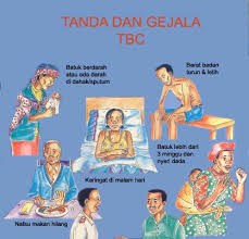 cara mengobati penyakit tbc