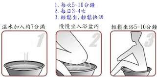 肛門保健 痔瘡 肛門廔管