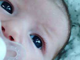 Résultat de recherche d'images pour "eye infection"