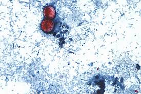 I study pathogens in sewage. Here’s how cyclospora could be getting into our food.