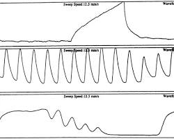 Immagine di oscillazioni cardiache in ventilazione