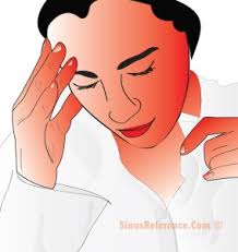 Image result for symptoms and sinus of sinusitis