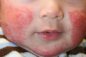 Image result for ruam lampin