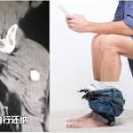  Chinese man's rectum fell off because he was sitting too long on the toilet