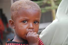 Résultat de recherche d'images pour "children starving"