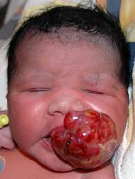 Resultado de imagen para patologias raras del mundo