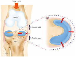 Schematic diagram demonstrating meniscus Wolff's law. When ...