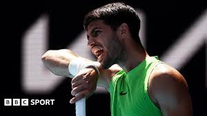 Australian Open 2026: Por que Carlos Alcaraz e Junk Sinner pediram para tirar os rastreadores de fitness?