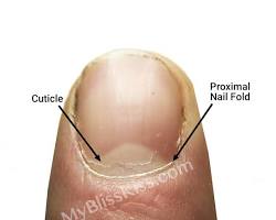 Image of Pushing back cuticles
