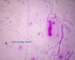 Image of tuberculosis microscopic images