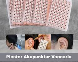 Gambar Plester akupunktur