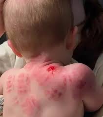Family Pursuing Legal Action Against Dickinson Daycare