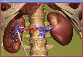 Glomerulonefritis Kronis