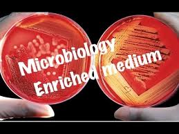 Image result for picture of  Enrichment media in microbiology