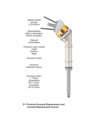 The MUTARS upper extremity portfolio offers proximal, distal ...