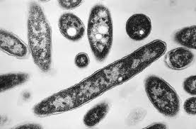 Legionnaires’ cluster grows on the Upper East Side: health department