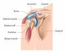 Shoulder Tendinitis Sierra Pacific Orthopedics