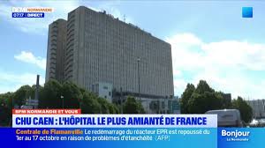 Normandie: CHU de Caen face à un défi majeur! Les détails ici!