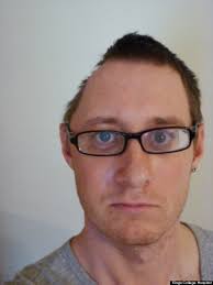 Resultado de imagen de dented