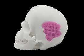 Scientists Can Now 3D Print Glass To Help Bones Grow Back ...