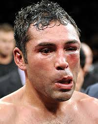 Oscar de la Hoya&#39;s face after his beat-down via Manny Pacquiao, December 6, 2008. (AP via http://boxingscene.com). - p1-oscar-de-la-hoya-ap