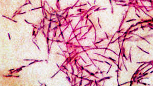 3rd person dies from Legionnaires' disease in New York City