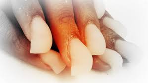 Image result for how to fix artificial nails