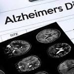  Alzheimer's costs Americans $277 billion a year -- and rising