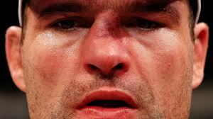 Shogun pede pisão e tiro de meta no UFC: &quot;machuca menos que cotovelada&quot; - Notícias - UOL Esporte - nariz-de-mauricio-shogun-fica-completamente-torto-apos-ser-atingido-e-nocauteado-por-dan-henderson-no-ufc-natal-1395654829406_1920x1080