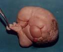 Image result for fetus in fetu images