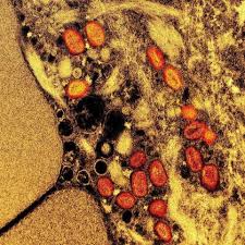 Brasil chega a 140 casos confirmados de mpox em 2026; veja lista por estado