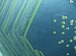 “Shigellose en France : Maladie dangereuse et résistante aux antibiotiques”